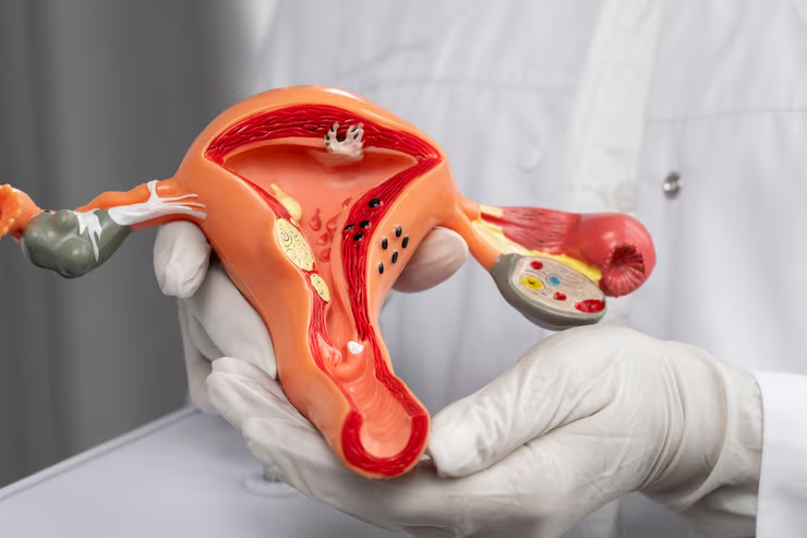 Vulval Cancer – Symptoms, Causes, Stages & Treatment image 2026 04 28 125719835
