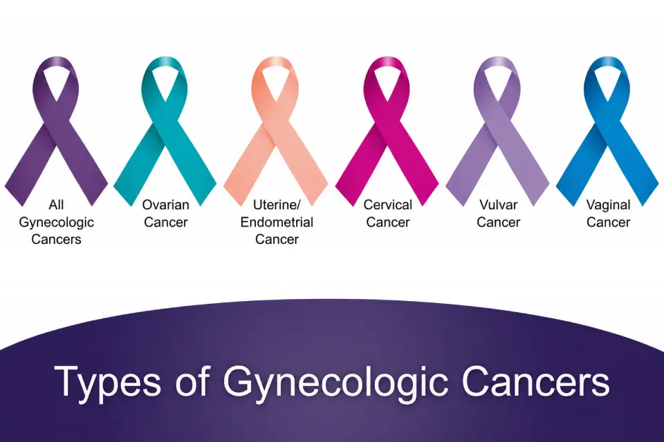 Awareness ribbons for different types of gynecologic cancers including ovarian, cervical, and endometrial cancer.