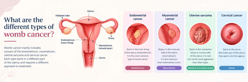 What Are the Different Types of Womb Cancer? types of womb cancer